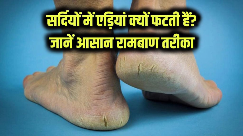 सर्दियों में क्यों फटती हैं एड़ियां? दिक्कत से निपटने का ये है रामबाण तरीका, जानें 1 winter cracked heels causes and fast healing